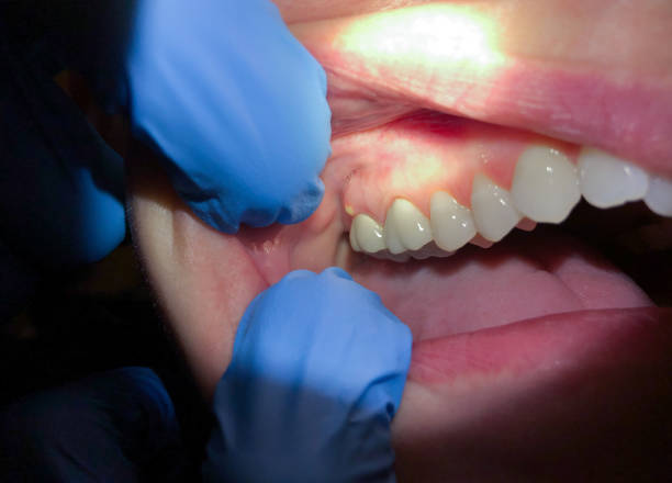 Best Broken Tooth Emergency  in Winnsboro Mills, SC
